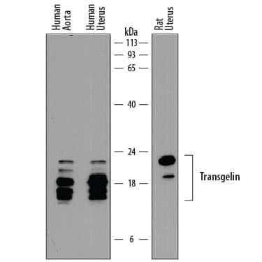 Western blot shows lysates of human aorta tissue, human uterus tissue, and rat uterus tissue. PVDF membrane was probed with 0.5 µg/mL of Mouse Anti-Human Transgelin/TAGLN Monoclonal Antibody (Catalog # MAB78861) followed by HRP-conjugated Anti-Mouse IgG Secondary Antibody (Catalog # HAF018). Specific bands were detected for Transgelin/TAGLN at approximately 16-24 kDa (as indicated). This experiment was conducted under reducing conditions and using Immunoblot Buffer Group 1.