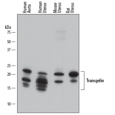 Western blot shows lysates of human aorta tissue, human uterus tissue, mouse uterus tissue, and rat uterus tissue. PVDF membrane was probed with 0.5 µg/mL of Mouse Anti-Human/Mouse/Rat Transgelin/ TAGLN Monoclonal Antibody (Catalog # MAB7886) followed by HRP-conjugated Anti-Mouse IgG Secondary Antibody (Catalog # HAF018). Specific bands were detected for Transgelin/TAGLN at approximately 16-24 kDa (as indicated). This experiment was conducted under reducing conditions and using Immunoblot Buffer Group 1.