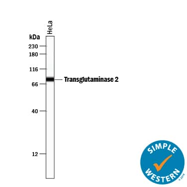 Simple Western Transglutaminase 2/TGM2 Antibody [Unconjugated]