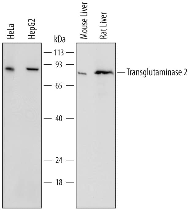 Western Blot Transglutaminase 2/TGM2 Antibody [Unconjugated]