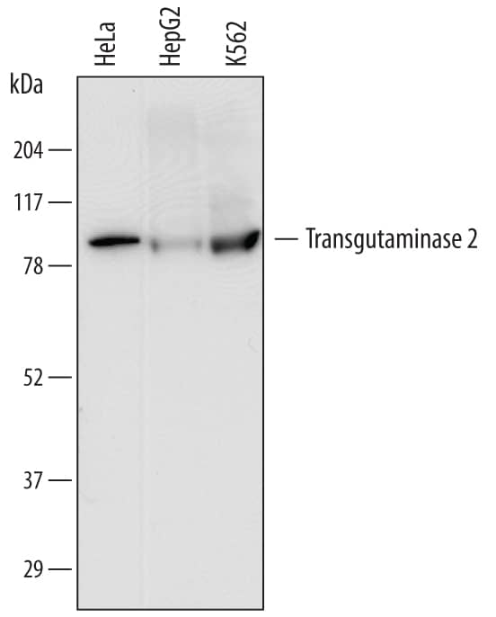 Western blot shows lysates of HeLa human cervical epithelial carcinoma cell line, HepG2 human hepatocellular carcinoma cell line, and K562 human chronic myelogenous leukemia cell line. PVDF membrane was probed with 1 µg/mL of Mouse Anti-Human Transglutaminase 2/TGM2 Monoclonal Antibody (Catalog # MAB4376) followed by HRP-conjugated Anti-Mouse IgG Secondary Antibody (Catalog # HAF007). A specific band was detected for Transglutaminase 2/TGM2 at approximately 85 kDa (as indicated). This experiment was conducted under reducing conditions and using Immunoblot Buffer Group 1.