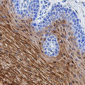 Immunohistochemistry Transglutaminase 3/TGM3 Antibody [Unconjugated]