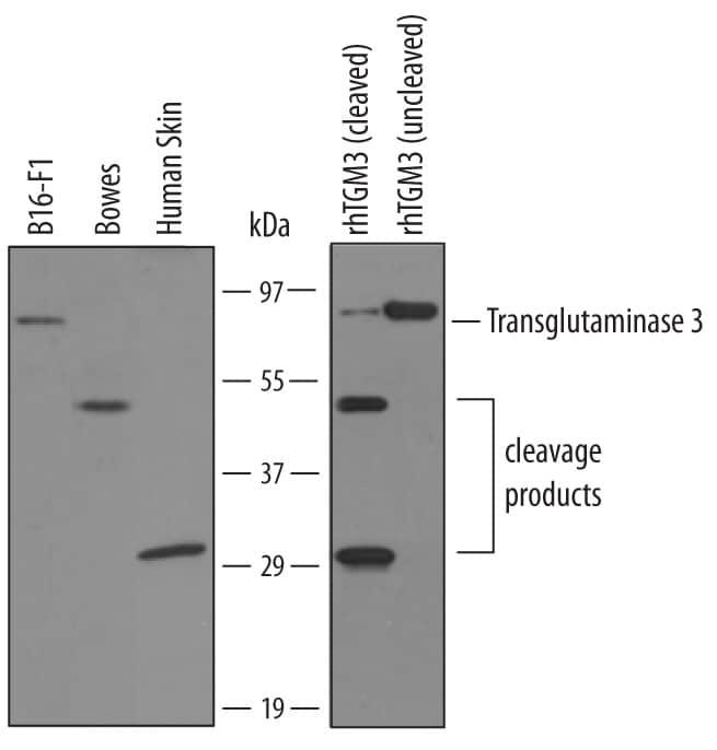 Western Blot Transglutaminase 3/TGM3 Antibody [Unconjugated]