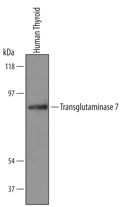 Western Blot Transglutaminase 7/TGM7 Antibody [Unconjugated]