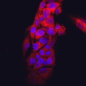 Immunocytochemistry Transthyretin/Prealbumin Antibody (760430)