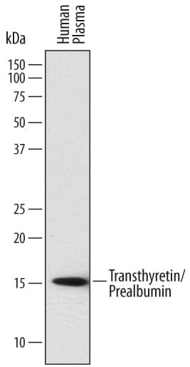 Western Blot Transthyretin/Prealbumin Antibody (760430)