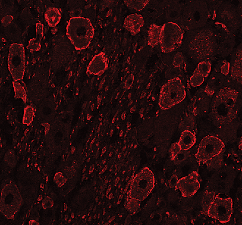 Immunohistochemistry TrkA Antibody [Unconjugated]