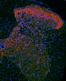TrkB was detected in perfusion fixed frozen sections of mouse spinal cord using Goat Anti-Human/Mouse/Rat TrkB Antigen Affinity-purified Polyclonal Antibody (Catalog # AF1494) at 1.7 µg/mL overnight at 4 °C. Tissue was stained using the NorthernLights™ 557-conjugated Anti-Goat IgG Secondary Antibody (red; NL001) and counterstained with DAPI (blue). Specific staining was localized to neuronal processes and cell bodies. View our protocol for Fluorescent IHC Staining of Frozen Tissue Sections.