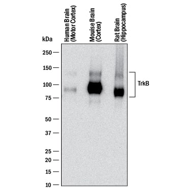 Western blot shows lysates of human brain (motor cortex) tissue, mouse brain (cortex) tissue, and rat brain (hippocampus) tissue. PVDF membrane was probed with 0.1 µg/mL of Goat Anti-Human/Mouse/Rat TrkB Antigen Affinity-purified Polyclonal Antibody (Catalog # AF1494) followed by HRP-conjugated Anti-Goat IgG Secondary Antibody (HAF017). Specific bands were detected for TrkB at approximately 95 kDa and 145 kDa (as indicated). This experiment was conducted under reducing conditions and using Immunoblot Buffer Group 1.