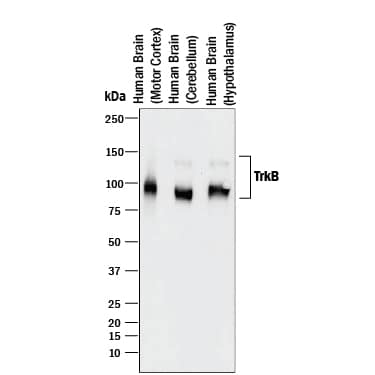 Western blot shows lysates of human brain (motor cortex) tissue, human brain (cerebellum) tissue, and human brain (hypothalamus) tissue. PVDF membrane was probed with 0.5 µg/mL of Goat Anti-Human/Mouse/Rat TrkB Antigen Affinity-purified Polyclonal Antibody (Catalog # AF397) followed by HRP-conjugated Anti-Goat IgG Secondary Antibody (HAF017). Specific bands were detected for TrkB at approximately 90-100 & 140 kDa (as indicated). This experiment was conducted under reducing conditions and using Immunoblot Buffer Group 1.