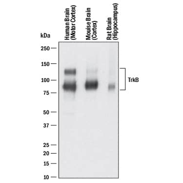 Western blot shows lysates of human brain (motor cortex) tissue, mouse brain (cortex) tissue, and rat brain (hippocampus) tissue. PVDF membrane was probed with 0.25 µg/mL of Goat Anti-Human/Mouse/Rat TrkB Antigen Affinity-purified Polyclonal Antibody (Catalog # AF397) followed by HRP-conjugated Anti-Goat IgG Secondary Antibody (HAF017). Specific bands were detected for TrkB at approximately 95 kDa and 145 kDa (as indicated). This experiment was conducted under reducing conditions and using Immunoblot Buffer Group 1.
