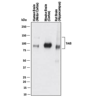 Western blot shows lysates of human brain (motor cortex) tissue, mouse brain (cortex) tissue, and rat brain (hippocampus) tissue. PVDF membrane was probed with 2 µg/mL of Rat Anti-Human/Mouse/Rat TrkB Monoclonal Antibody (Catalog # MAB1494) followed by HRP-conjugated Anti-Rat IgG Secondary Antibody (Catalog # HAF005). Specific bands were detected for TrkB at approximately 95 kDa and 145 kDa (as indicated). This experiment was conducted under reducing conditions and using Immunoblot Buffer Group 1.