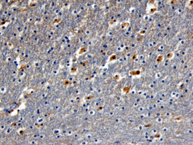 TrkB was detected in immersion fixed paraffin-embedded sections of human brain (hippocampus) using Mouse Anti-Human/Mouse/Rat TrkB Monoclonal Antibody (Catalog # MAB397) at 25 µg/mL overnight at 4 °C. Before incubation with the primary antibody tissue was subjected to heat-induced epitope retrieval using Antigen Retrieval Reagent-Basic (Catalog # CTS013). Tissue was stained using the Anti-Mouse HRP-DAB Cell & Tissue Staining Kit (brown; Catalog # CTS002) and counterstained with hematoxylin (blue). View our protocol for Chromogenic IHC Staining of Paraffin-embedded Tissue Sections.