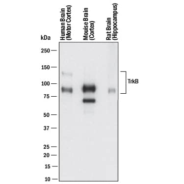 Western blot shows lysates of human brain (motor cortex) tissue, mouse brain (cortex) tissue, and rat brain (hippocampus) tissue. PVDF membrane was probed with 2 µg/mL of Mouse Anti-Human/Mouse/Rat TrkB Monoclonal Antibody (Catalog # MAB397) followed by HRP-conjugated Anti-Mouse IgG Secondary Antibody (Catalog # HAF018). Specific bands were detected for TrkB at approximately 95 kDa and 145 kDa (as indicated). This experiment was conducted under reducing conditions and using Immunoblot Buffer Group 1.