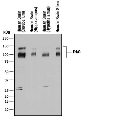 Western Blot TrkC Antibody [Unconjugated]