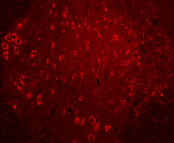 TrkC was detected in perfusion fixed frozen sections of rat spinal cord using 15 &micro;g/mL Mouse Anti-Human TrkC Monoclonal Antibody (Catalog # MAB373) overnight at 4 &deg;C. Tissue was stained (red). View our protocol for Fluorescent IHC Staining of Frozen Tissue Sections.