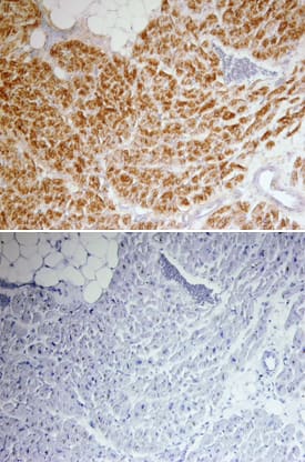 Troponin I/TNNI3 was detected in immersion fixed paraffin-embedded sections of human heart using Mouse Anti-Human Troponin I/TNNI3 Monoclonal Antibody (Catalog # MAB68871) at 15 &micro;g/mL overnight at 4 &deg;C. Tissue was stained using the Anti-Mouse HRP-DAB Cell & Tissue Staining Kit (brown; Catalog # CTS002) and counterstained with hematoxylin (blue). Lower panel shows a lack of labeling when primary antibodies are omitted and tissue is stained only with secondary antibody followed by incubation with detection reagents. Specific staining was localized to cardiac muscle. View our protocol for Chromogenic IHC Staining of Paraffin-embedded Tissue Sections.
