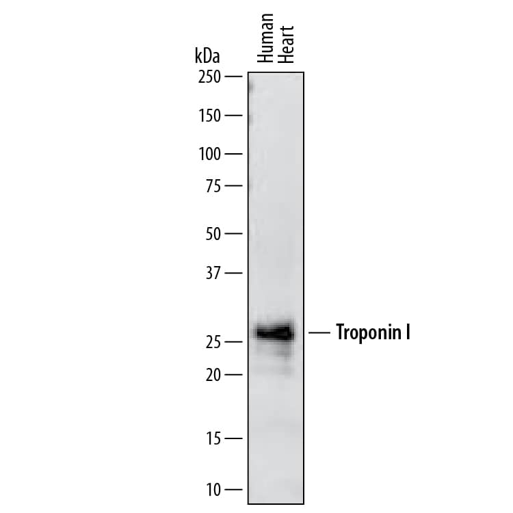 Western blot shows lysates of human heart tissue. PVDF membrane was probed with 1 µg/mL of Mouse Anti-Human Troponin I/TNNI3 Monoclonal Antibody (Catalog # MAB68871) followed by HRP-conjugated Anti-Mouse IgG Secondary Antibody (Catalog # HAF007). A specific band was detected for Troponin I/TNNI3 at approximately 24-29 kDa (as indicated). This experiment was conducted under reducing conditions and using Immunoblot Buffer Group 1.
