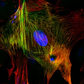 Troponin I/TNNI3 was detected in immersion fixed human embryonic stem cells, differentiated into cardiomyocytes using the StemXVivo Cardiomyocyte Differentiation Kit (Catalog # SC032), using Rabbit Anti-Human Troponin I/TNNI3 Monoclonal Antibody (Catalog # MAB8594) at 5 µg/mL for 3 hours at room temperature. Cells were stained using the NorthernLights™ 493-conjugated Anti-Rabbit IgG Secondary Antibody (green; Catalog # NL006). Cardiac Troponin T was also detected in cardiomyocytes using Mouse Anti-Human Cardiac Troponin T Monoclonal Antibody (Catalog # MAB1874). Cells were co-stained using the NorthernLights™ 557-conjugated Anti-Mouse IgG Secondary Antibody (red; Catalog # NL007) and counterstained with DAPI (blue). Specific staining of Troponin I/TNNI3 was localized to cardiac muscle fibrils. View our protocol for Fluorescent ICC Staining of Cells on Coverslips.