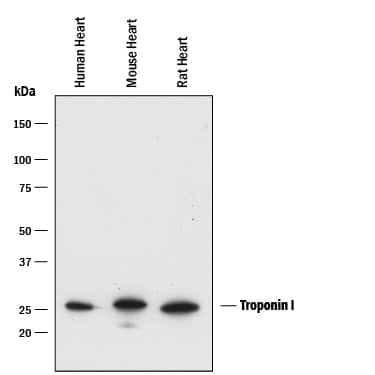 Western blot shows lysates of human heart tissue, mouse heart tissue, and rat heart tissue. PVDF membrane was probed with 0.1 µg/mL of Rabbit Anti-Human Troponin I/TNNI3 Monoclonal Antibody (Catalog # MAB8594) followed by HRP-conjugated Anti-Rabbit IgG Secondary Antibody (Catalog # HAF008). A specific band was detected for Troponin I/TNNI3 at approximately 25 kDa (as indicated). This experiment was conducted under reducing conditions and using Immunoblot Buffer Group 1.