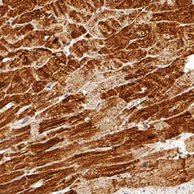 Immunohistochemistry Cardiac Troponin T Antibody (990007) [Unconjugated]