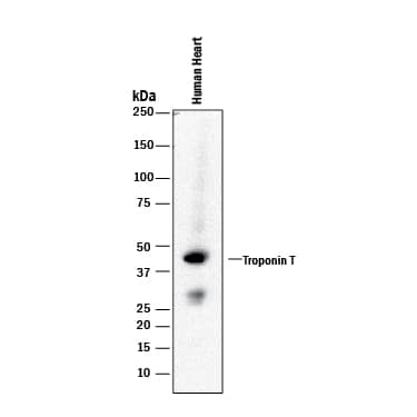 Western Blot Cardiac Troponin T Antibody (990007) [Unconjugated]