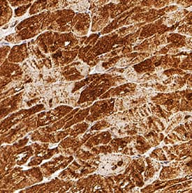 Immunohistochemistry Cardiac Troponin T Antibody (990033) [Unconjugated]