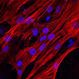 Immunocytochemistry Cardiac Troponin T Antibody (200805) [Unconjugated] - (Cardiac)