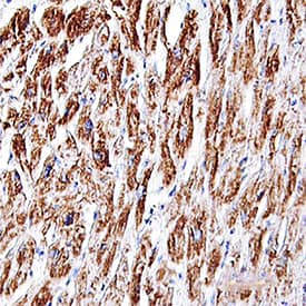 Immunohistochemistry Cardiac Troponin T Antibody (200805) [Unconjugated] - (Cardiac)