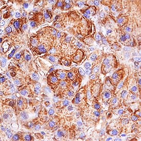Immunohistochemistry Trypsin 1/PRSS1 Antibody [Unconjugated]