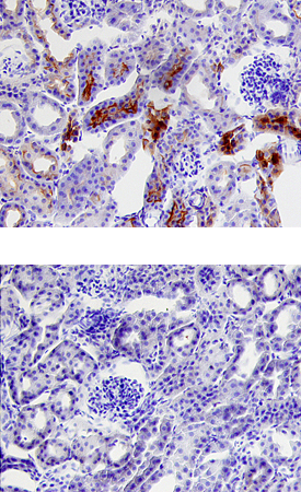 Trypsin 3/PRSS3 was detected in perfusion fixed frozen sections of mouse kidney using 25 µg/mL Rat Anti-Mouse Trypsin 3/ PRSS3 Monoclonal Antibody (Catalog # MAB3565) overnight at 4 °C. Tissue was stained with the Anti-Rat HRP-DAB Cell & Tissue Staining Kit (brown; Catalog # CTS017) and counterstained with hematoxylin (blue). Lower panel shows a lack of labeling if primary antibodies are omitted and tissue is stained only with secondary antibody followed by incubation with detection reagents. View our protocol for Chromogenic IHC Staining of Frozen Tissue Sections.