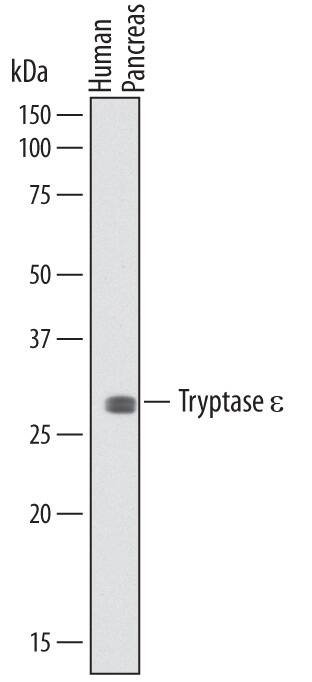 Western Blot Tryptase epsilon/BSSP-4/PRSS22 Antibody (725445)