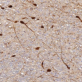 Immunohistochemistry Tryptophan Hydroxylase 1/TPH-1 Antibody [Unconjugated]