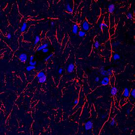 Immunohistochemistry Tryptophan Hydroxylase 1/TPH-1 Antibody [Unconjugated]