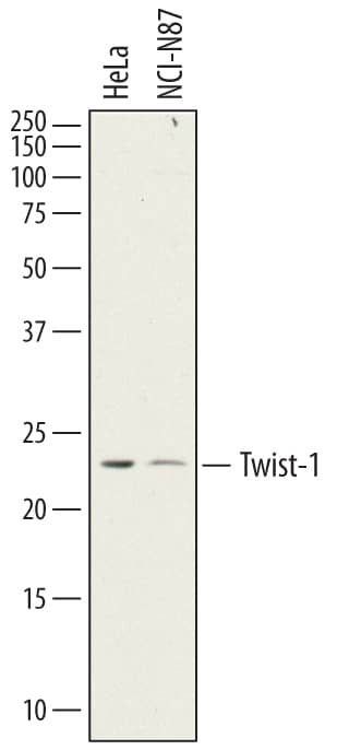 Western blot shows lysates of HeLa human cervical epithelial carcinoma cell line and NCI-N87 human gastric carcinoma cell line. PVDF membrane was probed with 2 µg/mL of Sheep Anti-Human Twist-1 Antigen Affinity-purified Polyclonal Antibody (Catalog # AF62301) followed by HRP-conjugated Anti-Sheep IgG Secondary Antibody (Catalog # HAF016). A specific band was detected for Twist-1 at approximately 24 kDa (as indicated). This experiment was conducted under reducing conditions and using Immunoblot Buffer Group 1.