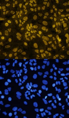 Twist-1 was detected in immersion fixed A549 human lung carcinoma cell line treated with 10ng/mL of Recombinant Human TGF beta 1 (Catalog # 240-B) for 48 hours using Sheep Anti-Human Twist-1 Antigen Affinity-purified Polyclonal Antibody (Catalog # AF6230) at 10 µg/mL for 3 hours at room temperature. Cells were stained using the NorthernLights™ 557-conjugated Anti-Sheep IgG Secondary Antibody (yellow, upper panel; Catalog # NL010) and counterstained with DAPI (blue, lower panel). Specific staining was localized to nuclei. View our protocol for Fluorescent ICC Staining of Cells on Coverslips.