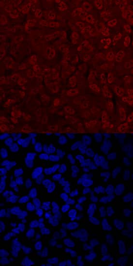Twist-2 was detected in immersion fixed A549 human lung carcinoma cells treated with Recombinant Human TGF-beta  1 (Catalog # 240-B) using Human Twist-2 Antigen Affinity-purified Polyclonal Antibody (Catalog # AF6249) at 10 µg/mL for 3 hours at room temperature. Cells were stained using the NorthernLights™ 557-conjugated Anti-Sheep IgG Secondary Antibody (red, upper panel; Catalog # NL010) and counterstained with DAPI (blue, lower panel). Specific staining was localized to nuclei and cytoplasm. View our protocol for Fluorescent ICC Staining of Cells on Coverslips.