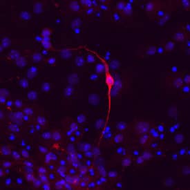 Tyrosine Hydroxylase was detected in immersion fixed D3 mouse embryonic stem cells using Sheep Anti-Human Tyrosine Hydroxylase Antigen Affinity-purified Polyclonal Antibody (Catalog # AF7566) at 10 µg/mL for 3 hours at room temperature. Cells were differentiated into dopaminergic neurons using R&D Systems Human/Mouse Dopaminergic Neuron Differentiation Kit (SC001B). Cells were stained using the NorthernLights™ 557-conjugated Anti-Sheep IgG Secondary Antibody (red; NL010) and counterstained with DAPI (blue). Specific staining was localized to dopaminergic neurons. View our protocol for Fluorescent ICC Staining of Cells on Coverslips.