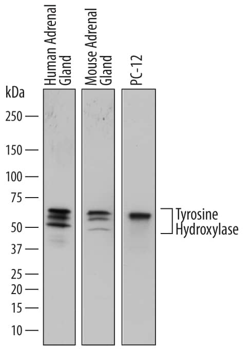 Western blot shows lysates of human adrenal gland tissue, mouse adrenal gland tissue, and PC-12 rat adrenal pheochromocytoma cell line. PVDF membrane was probed with 1 µg/mL of Sheep Anti-Human Tyrosine Hydroxylase Antigen Affinity-purified Polyclonal Antibody (Catalog # AF7566) followed by HRP-conjugated Anti-Sheep IgG Secondary Antibody (Catalog # HAF016). Specific bands were detected for Tyrosine Hydroxylase at approximately 56-60 kDa (as indicated). This experiment was conducted under reducing conditions and using Immunoblot Buffer Group 1.