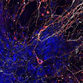Immunocytochemistry Tyrosine Hydroxylase Antibody (779427)