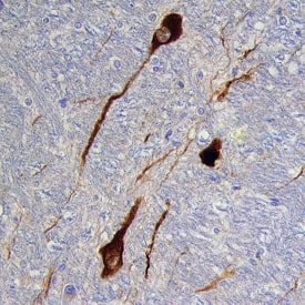Immunohistochemistry Tyrosine Hydroxylase Antibody (779427)