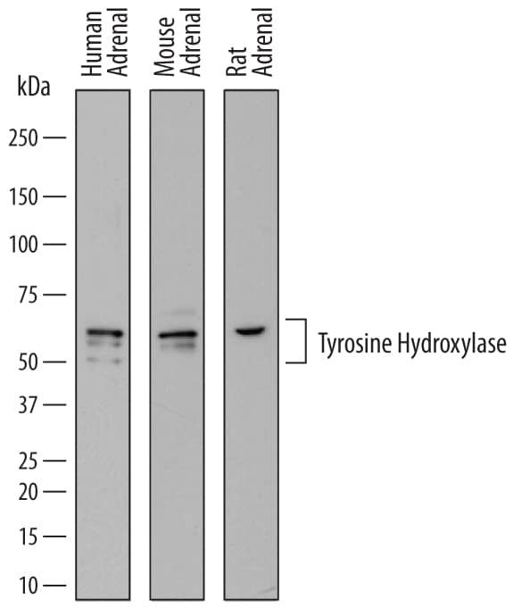 Western Blot Tyrosine Hydroxylase Antibody (779427)