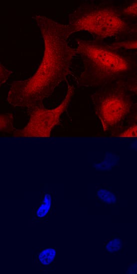 Immunocytochemistry UBASH3B/STS1/Tula-2 Antibody