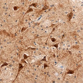 Immunohistochemistry UBE2K/E2-25K Antibody (701316)