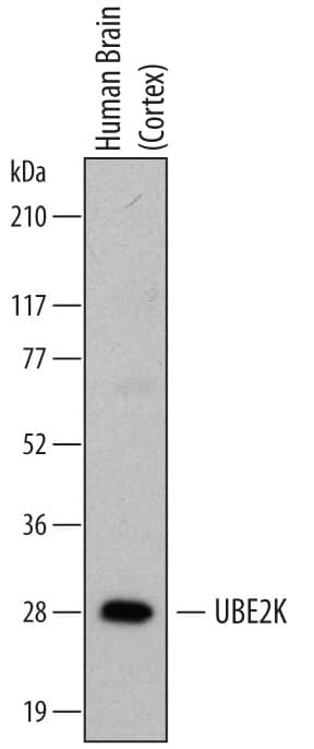 Western Blot UBE2K/E2-25K Antibody (701316)