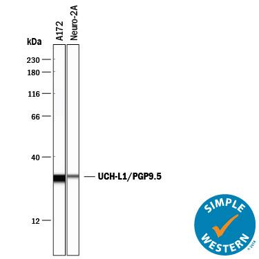 Simple Western lane view shows lysates of A172 human glioblastoma cell line and Neuro-2A mouse neuroblastoma cell line, loaded at 0.2 mg/mL. A specific band was detected for UCH-L1/ PGP9.5 at approximately 30 kDa (as indicated) using 10 µg/mL of Sheep Anti-Human/Mouse/Rat UCH-L1/PGP9.5 Antigen Affinity-purified Polyclonal Antibody (Catalog # AF6007) followed by 1:50 dilution of HRP-conjugated Anti-Sheep IgG Secondary Antibody (Catalog # HAF016). This experiment was conducted under reducing conditions and using the 12-230 kDa separation system.