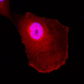 UCH-L1/PGP9.5 was detected in immersion fixed A172 human glioblastoma cell line using Mouse Anti-Human UCH-L1/PGP9.5 Monoclonal Antibody (Catalog # MAB60072) at 0.3 µg/mL for 3 hours at room temperature. Cells were stained using the NorthernLights™ 557-conjugated Anti-Mouse IgG Secondary Antibody (red; Catalog # NL007) and counterstained with DAPI (blue). Specific staining was localized to cytoplasm. View our protocol for Fluorescent ICC Staining of Cells on Coverslips.