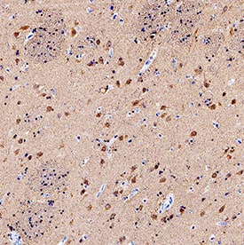 UCH-L1/PGP9.5 was detected in immersion fixed paraffin-embedded sections of human brain (caudate nucleus) using Mouse Anti-Human UCH-L1/PGP9.5 Monoclonal Antibody (Catalog # MAB60072) at 5 µg/mL for 1 hour at room temperature followed by incubation with the Anti-Mouse IgG VisUCyte™ HRP Polymer Antibody (Catalog # VC001). Tissue was stained using DAB (brown) and counterstained with hematoxylin (blue). Specific staining was localized to cytoplasm. View our protocol for IHC Staining with VisUCyte HRP Polymer Detection Reagents.