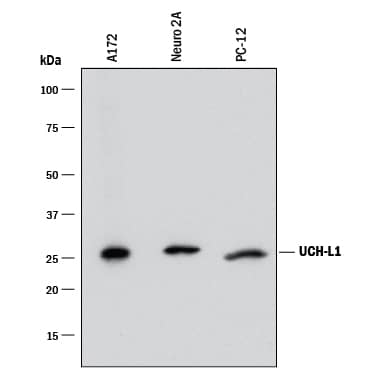 Western blot shows lysates of A172 human glioblastoma cell line, Neuro-2A mouse neuroblastoma cell line, and PC-12 rat adrenal pheochromocytoma cell line. PVDF membrane was probed with 0.1 µg/mL of Mouse Anti-Human UCH-L1/PGP9.5 Monoclonal Antibody (Catalog # MAB60072) followed by HRP-conjugated Anti-Mouse IgG Secondary Antibody (Catalog # HAF018). A specific band was detected for UCH-L1/PGP9.5 at approximately 26 kDa (as indicated). This experiment was conducted under reducing conditions and using Immunoblot Buffer Group 1.