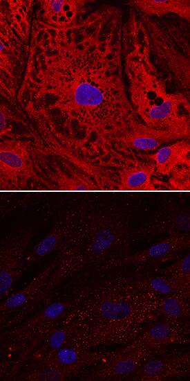 UCP1 was detected in immersion fixed human mesenchymal stem cells undifferentiated (lower panel) or differentiated into adipocytes (upper panel) using Mouse Anti-Human/Mouse UCP1 Monoclonal Antibody (Catalog # MAB6158) at 10 µg/mL for 3 hours at room temperature. Cells were stained using the NorthernLights™ 557-conjugated Anti-Mouse IgG Secondary Antibody (red; Catalog # NL007) and counterstained with DAPI (blue). Specific staining was localized to cytoplasm. View our protocol for Fluorescent ICC Staining of Stem Cells on Coverslips.